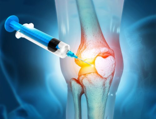 PRP for Knee Pain: A Revolutionary Treatment Option