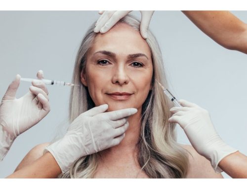 What to Expect During a Botox Treatment